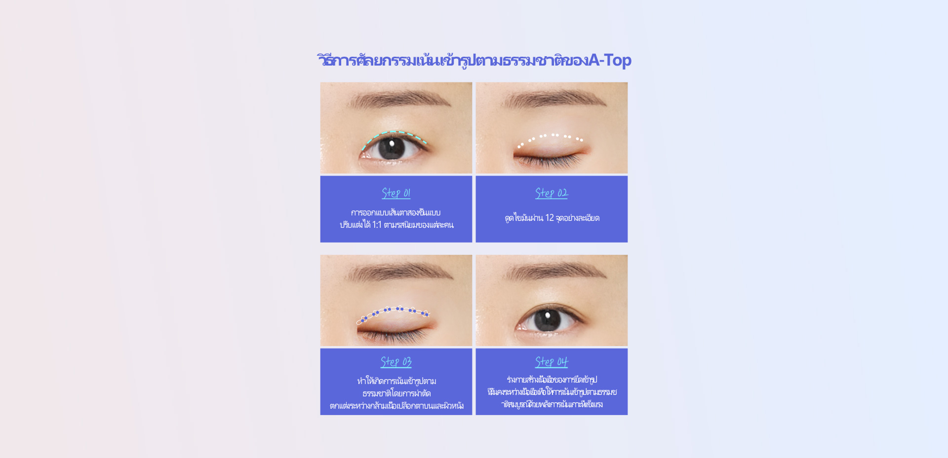 핏미 자연유착
