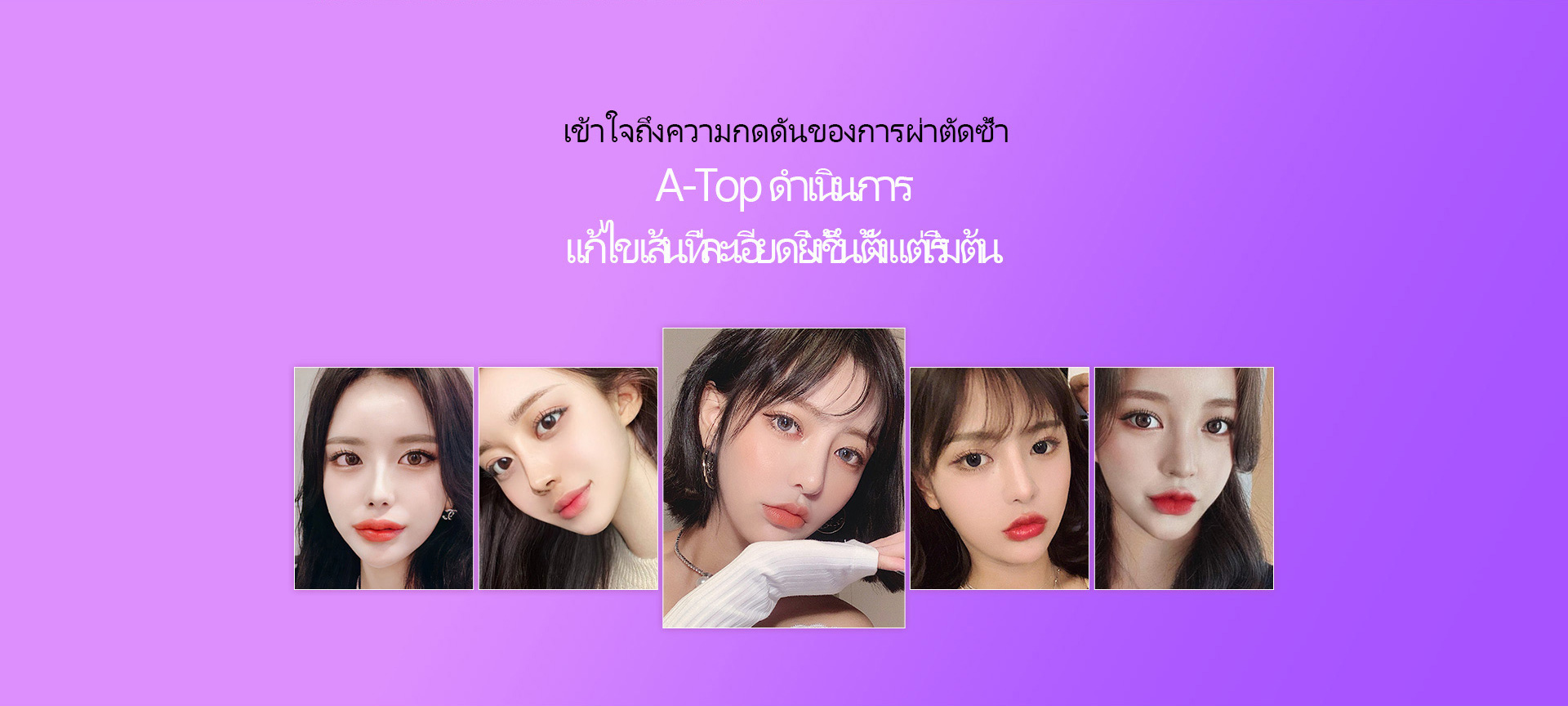 눈재수술