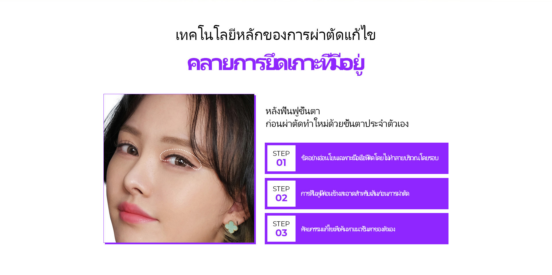 눈재수술