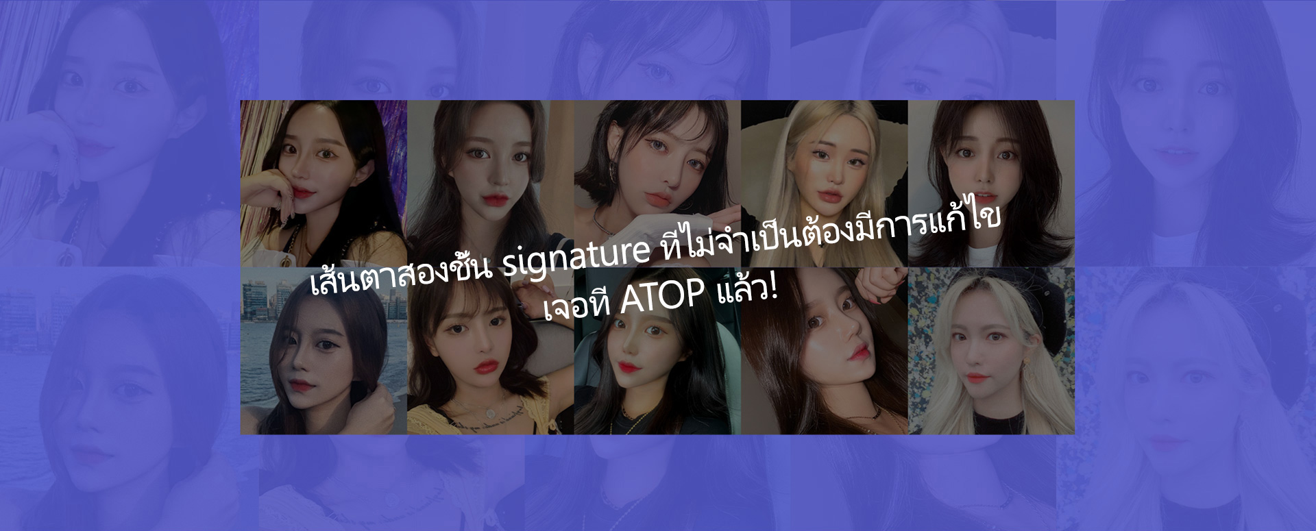 히든스카절개눈성형