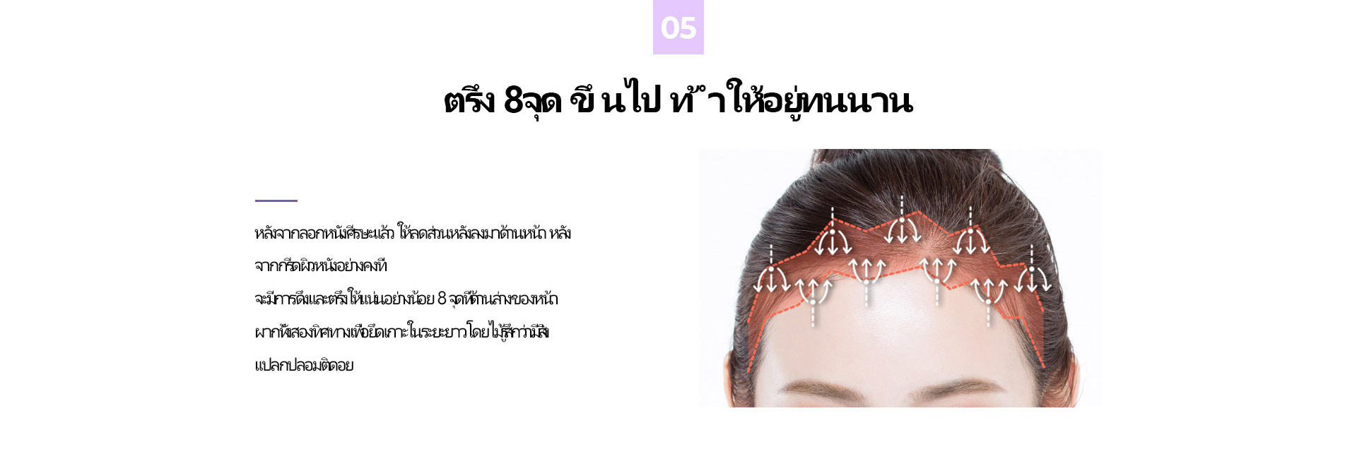 시그니처 이마축소
