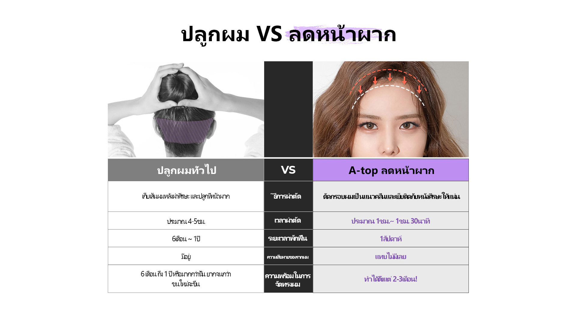 시그니처 이마축소