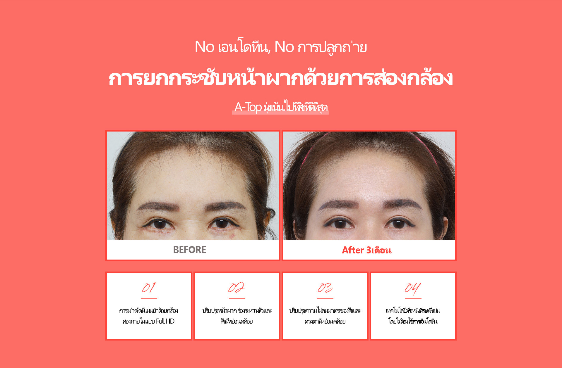 내시경 이마거상