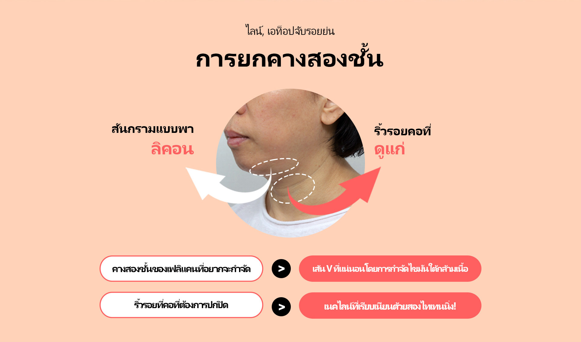 이중턱착붙리프팅