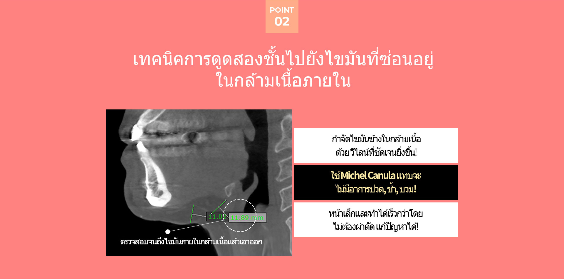 이중턱착붙리프팅