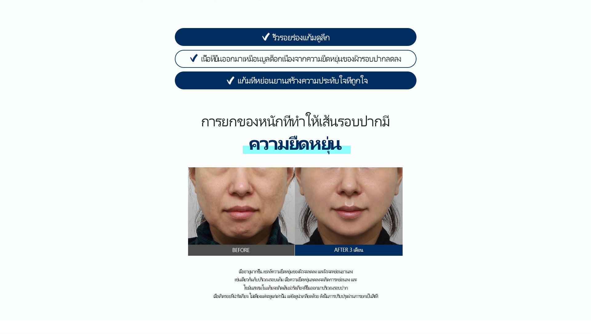 심술보리프팅