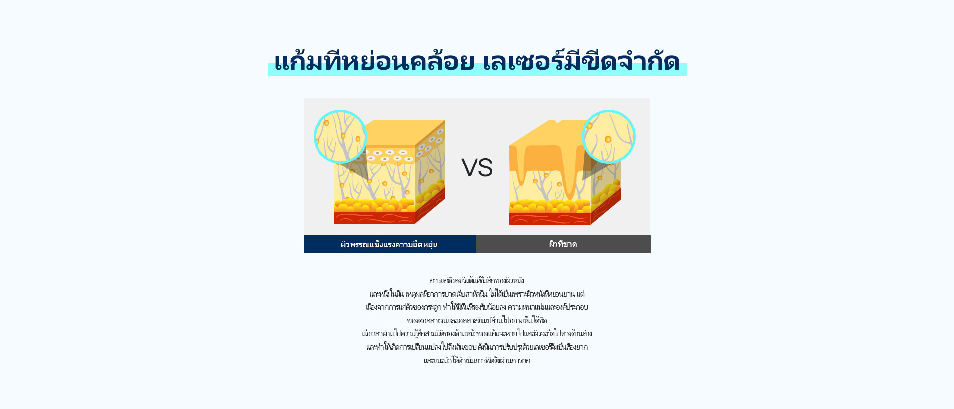 심술보리프팅