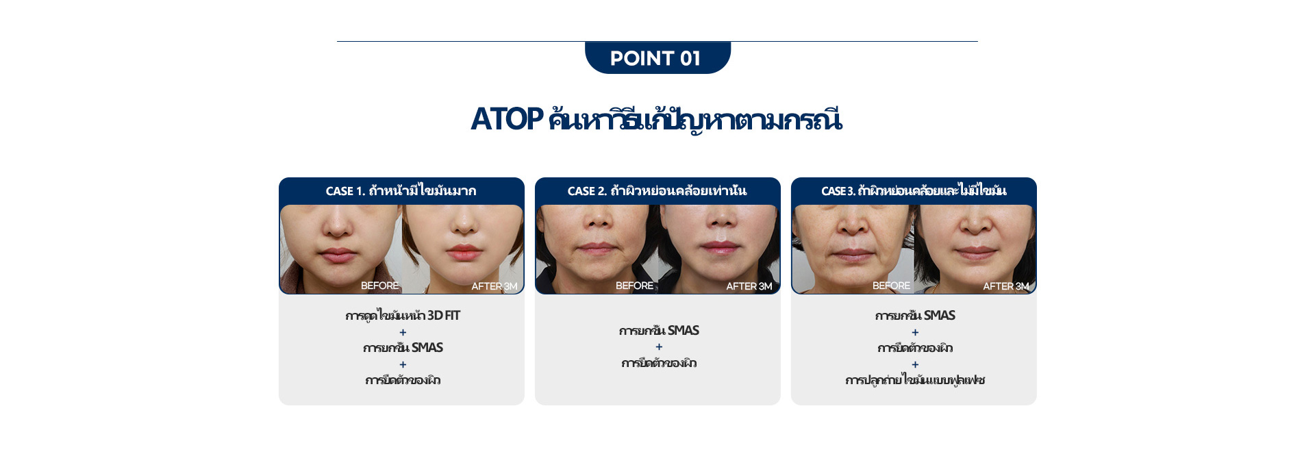심술보리프팅