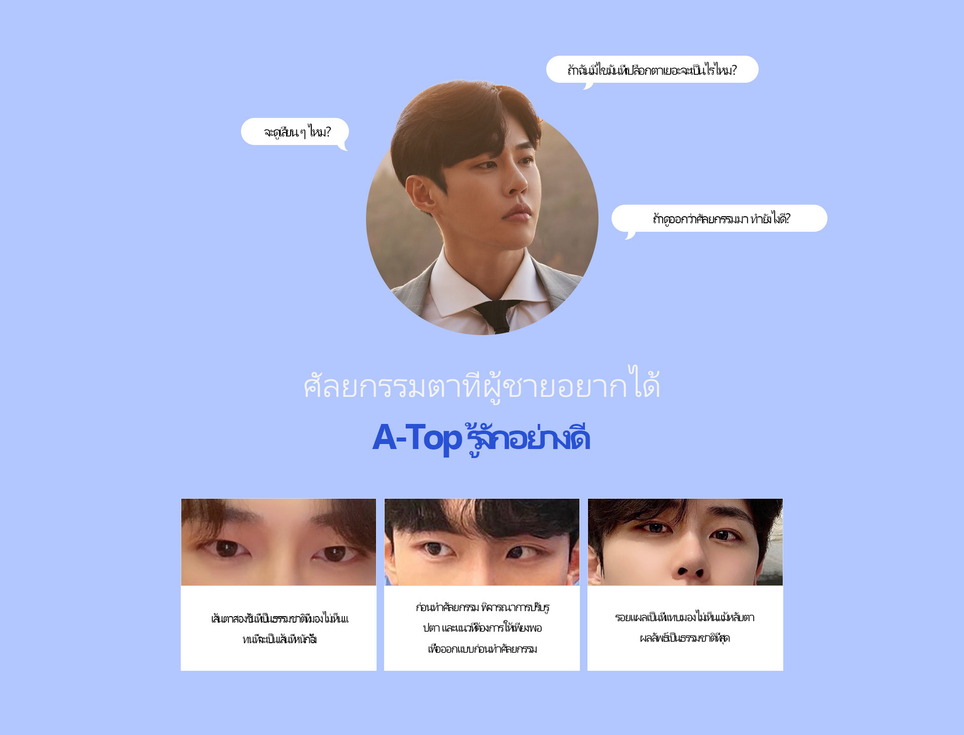 슬림라인 눈성형