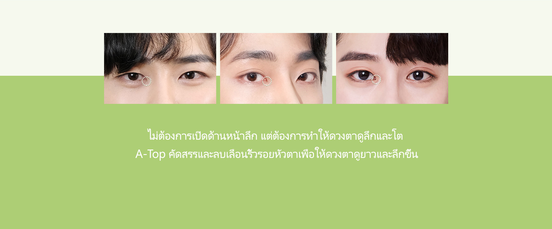 남자 트임성형
