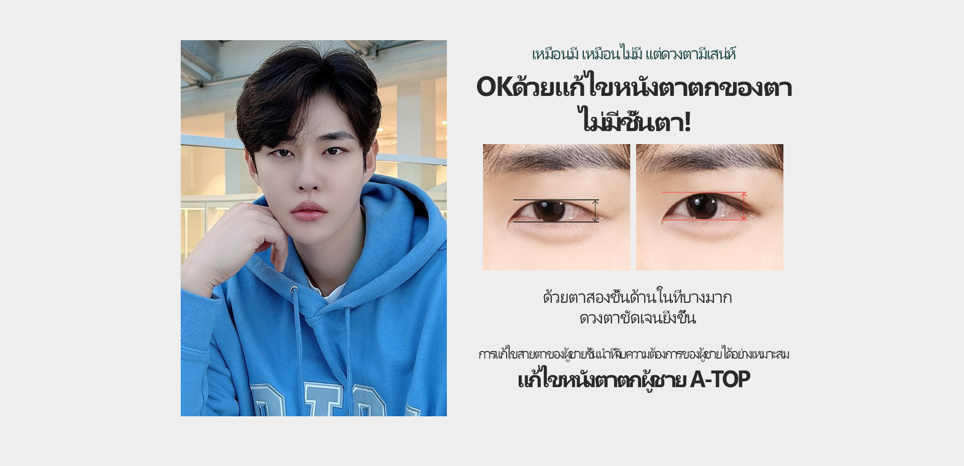 남자 눈매교정