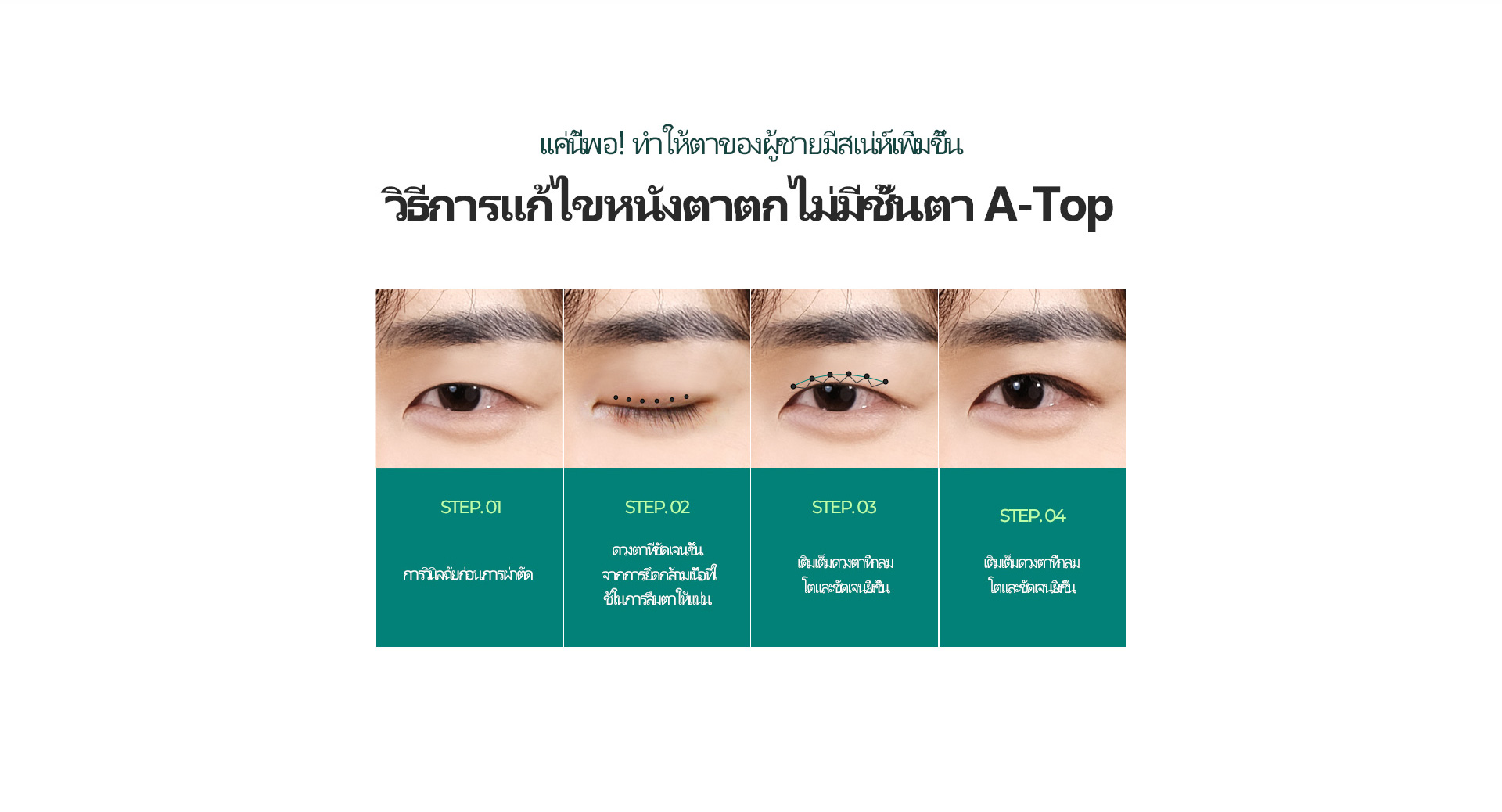 남자 눈매교정