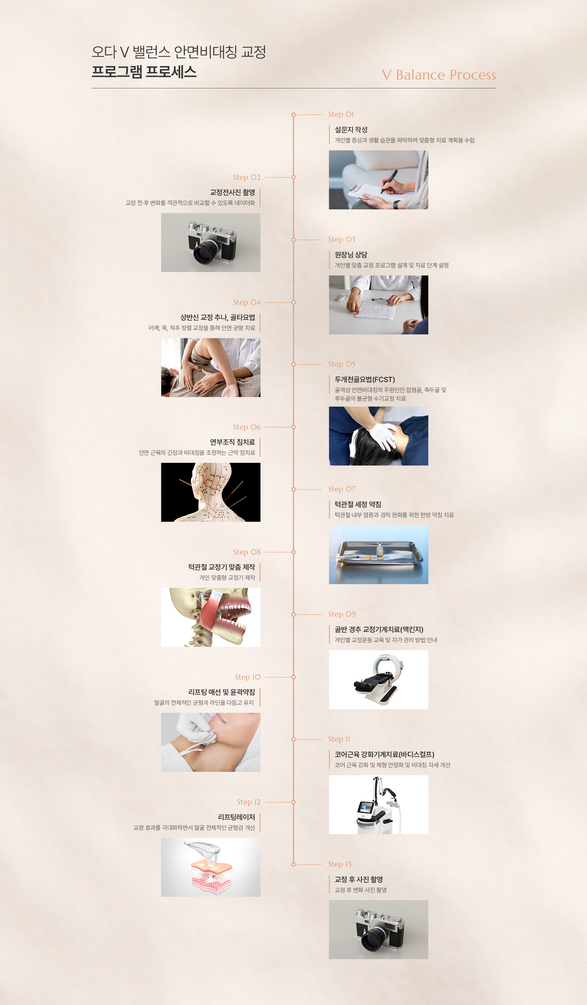 안면비대칭 상세05