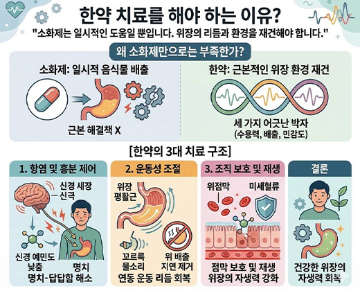 기능성 소화불량 키비주얼