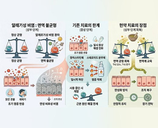 알레르기성 비염 키비주얼