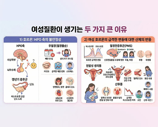 여성질환 키비주얼